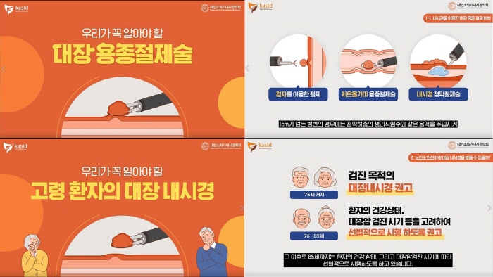 대한소화기내시경학회-대한장연구학회, 유튜브 영상 2편 공개