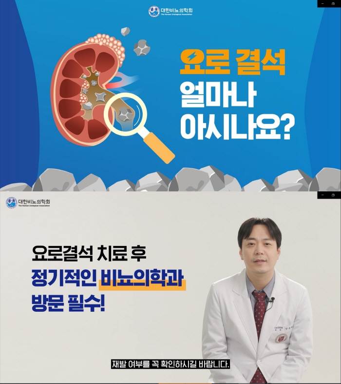 대한비뇨의학회, '요로결석 얼마나 아시나요?' 동영상 공개