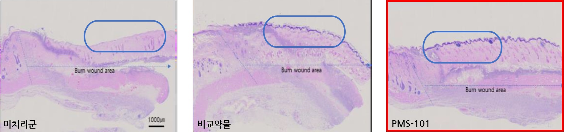 강스템바이오텍, 합병 통해 '엑소좀·화상' 치료제 시장 도전