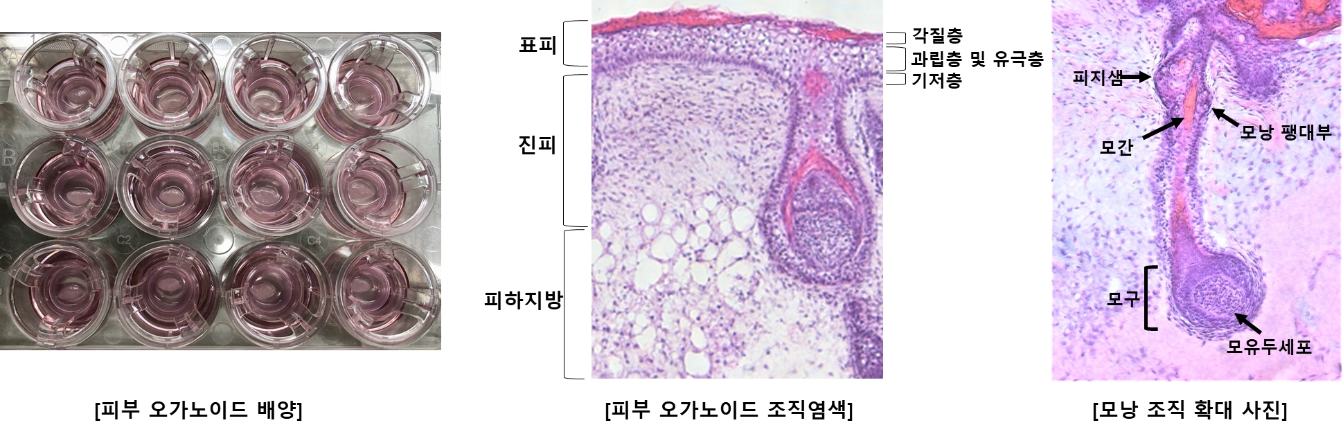 강스템바이오텍, 피부 오가노이드 아토피 모델 제작기술 특허 등록